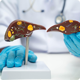 Liver Transplant in Dubai
