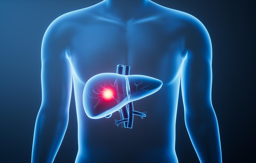 Hepatitis