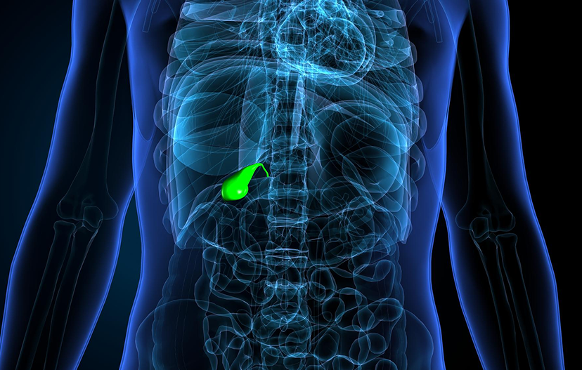 Gallstone disease