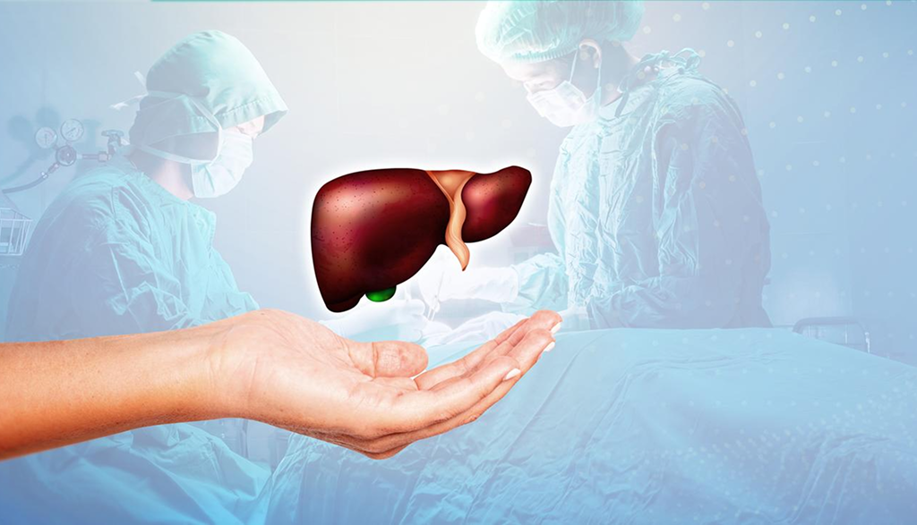 Liver Cancer - سرطان الكبد