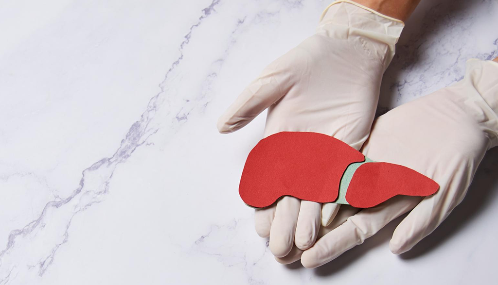Split Cadaveric Liver Transplants