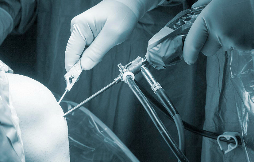 Minimally Invasive and Microsurgical Procedures