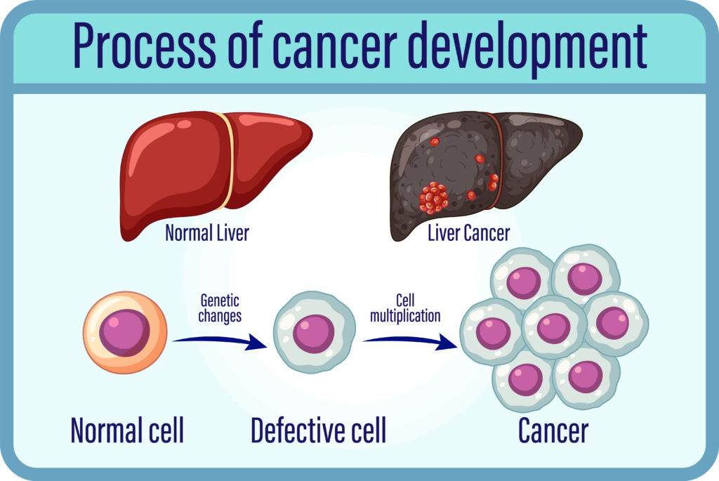Process of cancer development