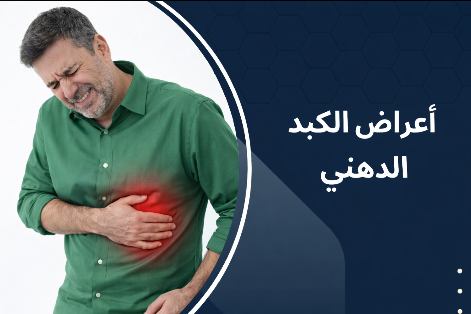 اعراض الكبد الدهني