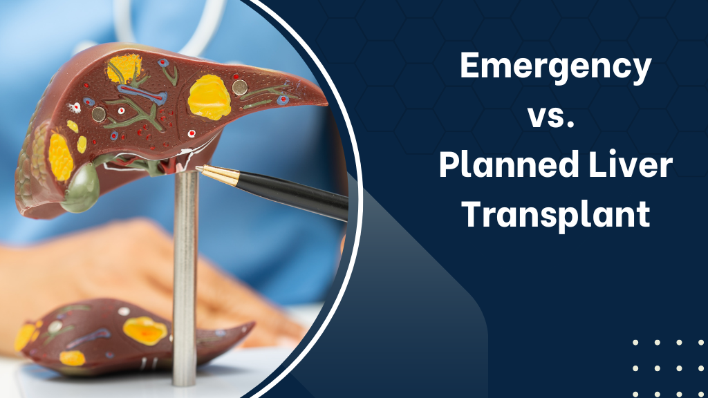 Emergency vs. Planned Liver Transplant