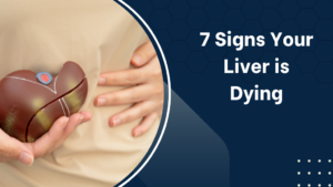 7 Signs Your Liver is Dying