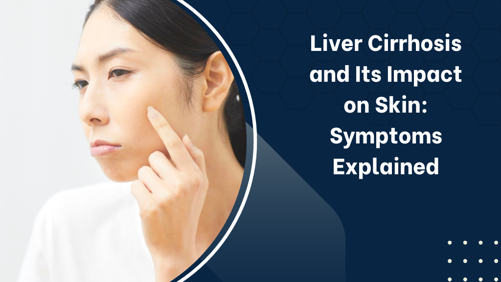 Liver Cirrhosis and Its Impact on Skin Symptoms Explained