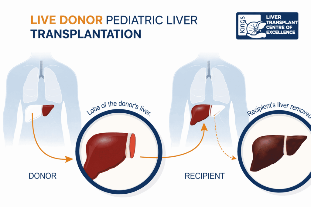 child liver transplant