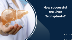 How successful are Liver Transplants?