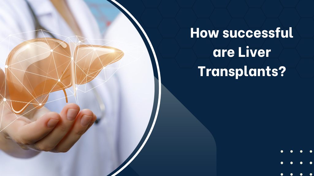 How successful are Liver Transplants?