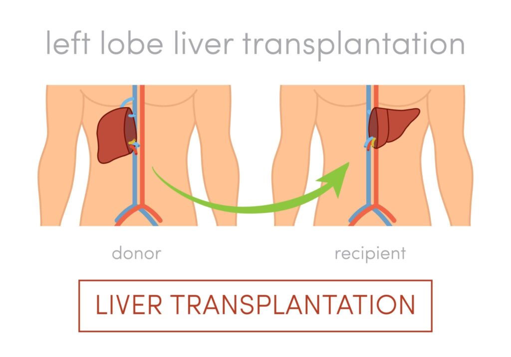 Understanding liver donation