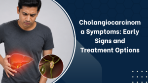 Cholangiocarcinoma Symptoms