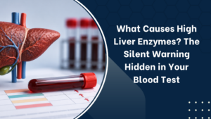 what causes high liver enzymes