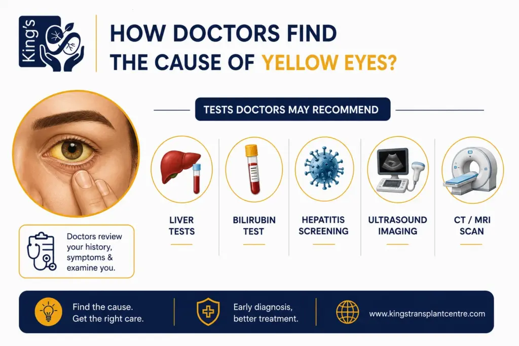 what causes yellow eyes